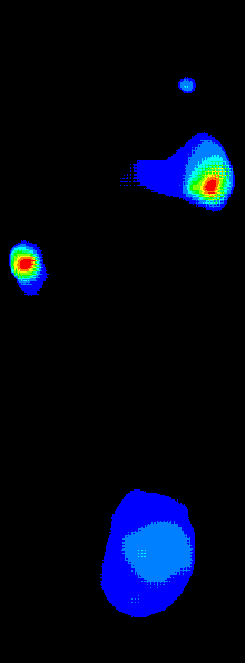Plantar Pressure Adjust to B